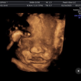 Babylist Registry Photo.