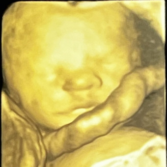 Babylist Registry Photo.