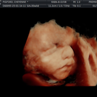 Babylist Registry Photo.