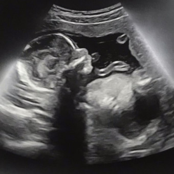 Babylist Registry Photo.