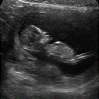 Babylist Registry Photo.