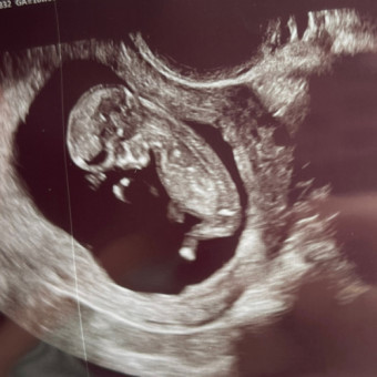 Babylist Registry Photo.
