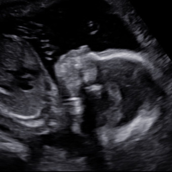 Babylist Registry Photo.