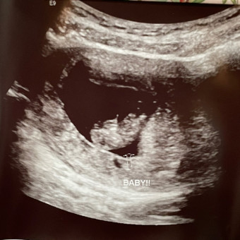 Babylist Registry Photo.