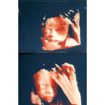 Babylist Registry Photo.