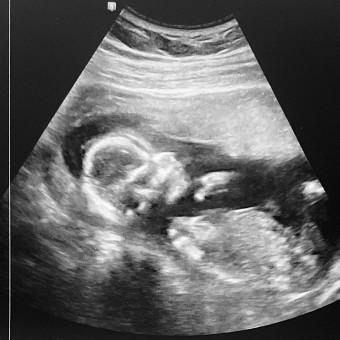 Babylist Registry Photo.