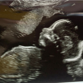 Babylist Registry Photo.