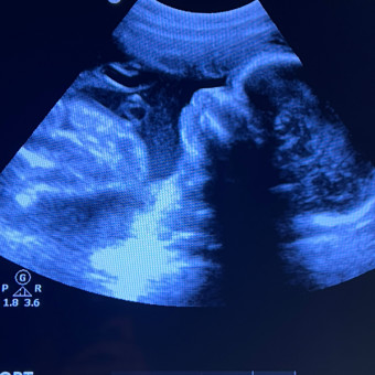 Babylist Registry Photo.