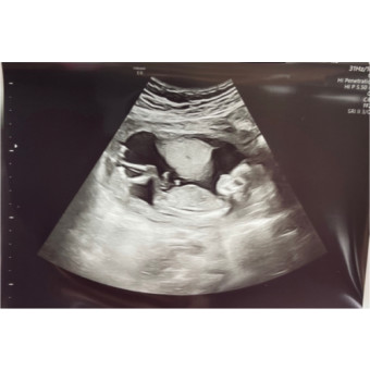 Babylist Registry Photo.