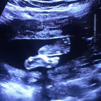 Babylist Registry Photo.