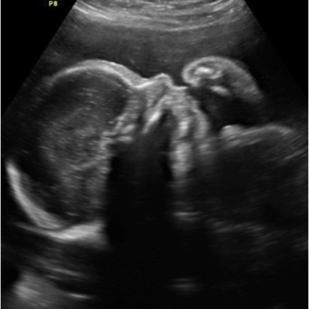 Babylist Registry Photo.