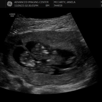 Babylist Registry Photo.