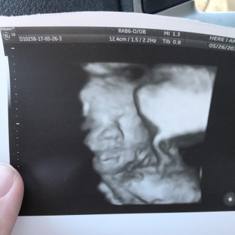 Babylist Registry Photo.