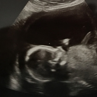 Babylist Registry Photo.