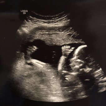 Babylist Registry Photo.