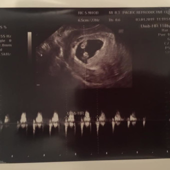 Babylist Registry Photo.
