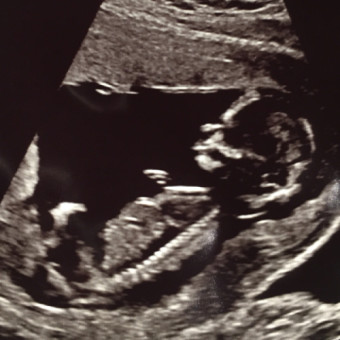 Babylist Registry Photo.