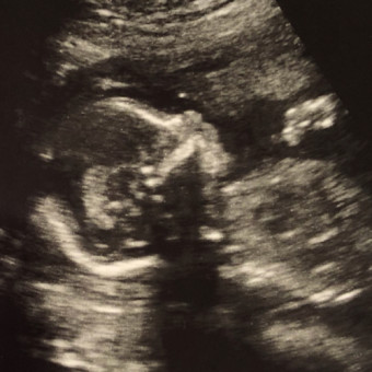 Babylist Registry Photo.