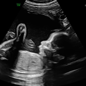 Babylist Registry Photo.