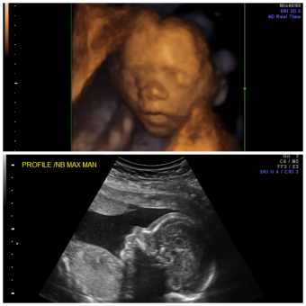 Babylist Registry Photo.