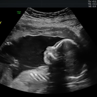 Babylist Registry Photo.