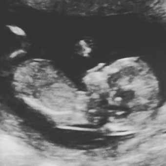 Babylist Registry Photo.