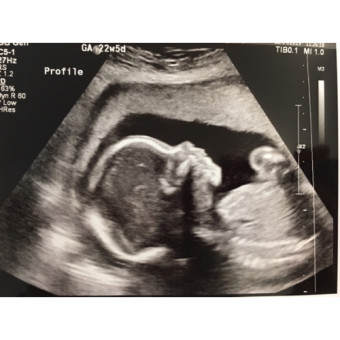 Babylist Registry Photo.