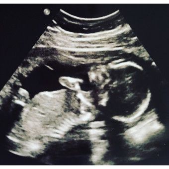 Babylist Registry Photo.