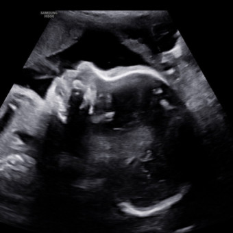 Babylist Registry Photo.