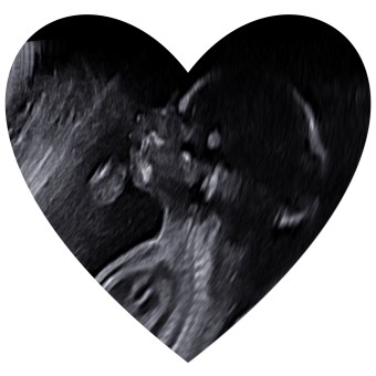 Babylist Registry Photo.