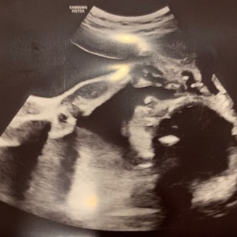 Babylist Registry Photo.