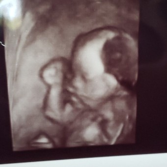 34 x 16 changing pad