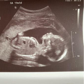 Babylist Registry Photo.