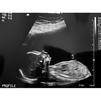 Babylist Registry Photo.
