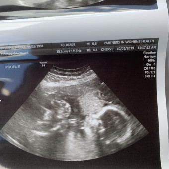 Babylist Registry Photo.