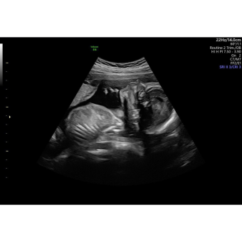 Babylist Registry Photo.