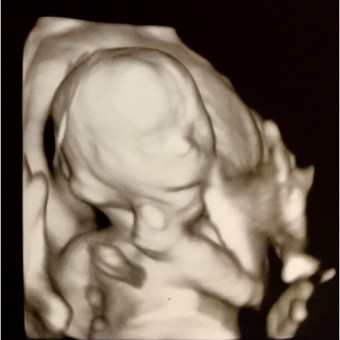 Babylist Registry Photo.