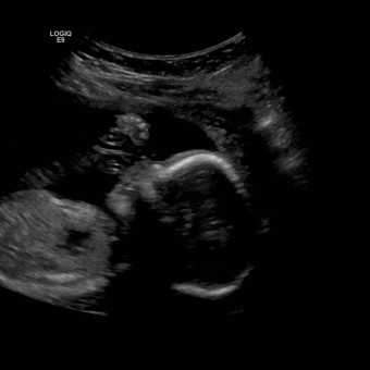 Babylist Registry Photo.