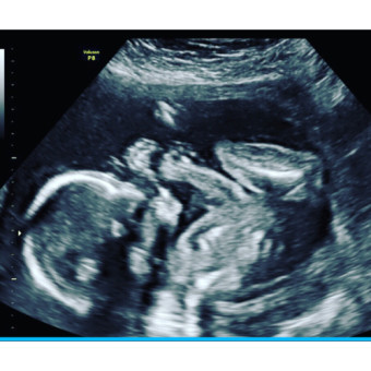 Babylist Registry Photo.