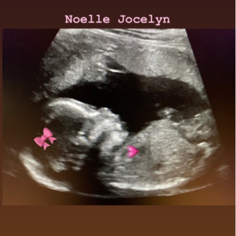 Babylist Registry Photo.