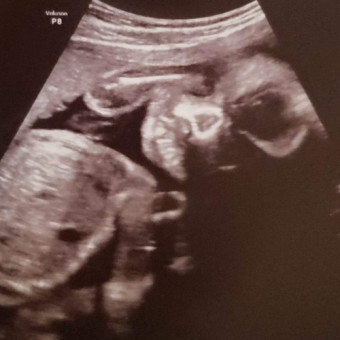 Babylist Registry Photo.