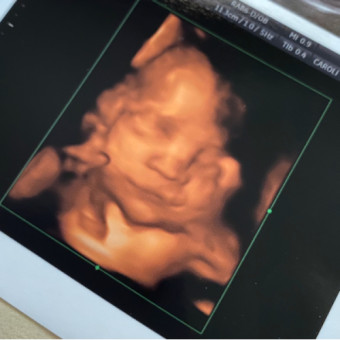 Babylist Registry Photo.