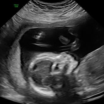 Babylist Registry Photo.