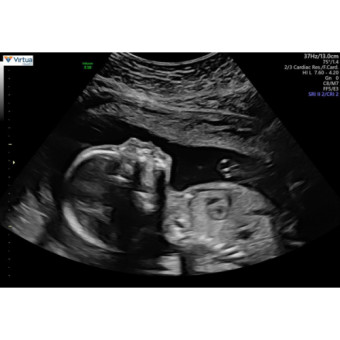 Babylist Registry Photo.