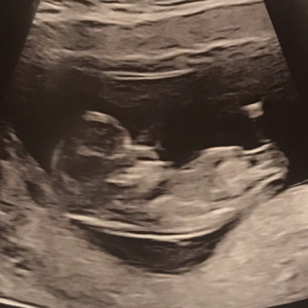 Babylist Registry Photo.