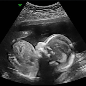 Babylist Registry Photo.