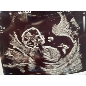 Babylist Registry Photo.