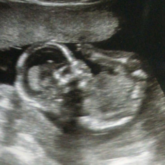 Babylist Registry Photo.