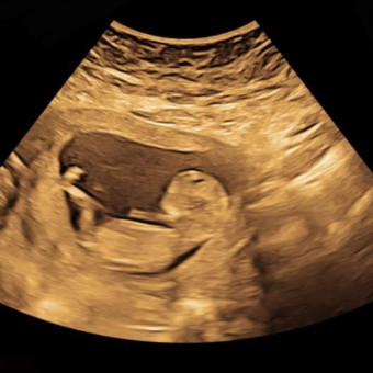 Babylist Registry Photo.