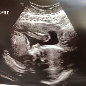 Babylist Registry Photo.